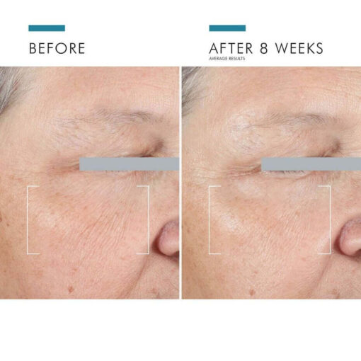 A.G.E. Advanced Eye for Dark Circles - Image 7